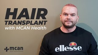 Hair Transplant In Turkey With Mcan Health Patient Review From Ireland