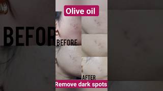 Oil Dark Spots Live Result Pls Subscribe