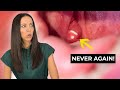 How to PREVENT Tonsil Stones