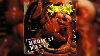 Watch Impaled Medical Waste video