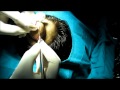 Large Sebaceous Cyst Scalp Removal Surgery