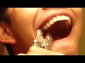 TOOTH!!