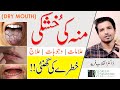 DRY MOUTH | خشک منہ | Signs | Causes | Home Remedies | Treatment | हिन्दी | @InqalabFareed