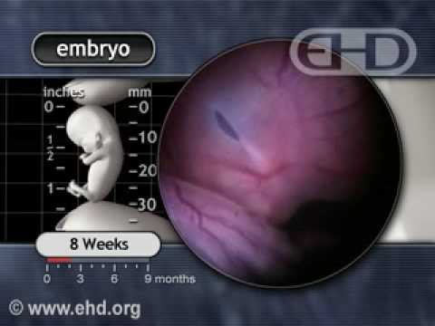 The Human Embryo Eight Weeks After Conception - YouTube