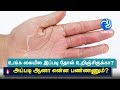 Home Remedy to Get Rid of Hand Skin Peeling | Skin Peeling off Hands Treatment Tamil TV