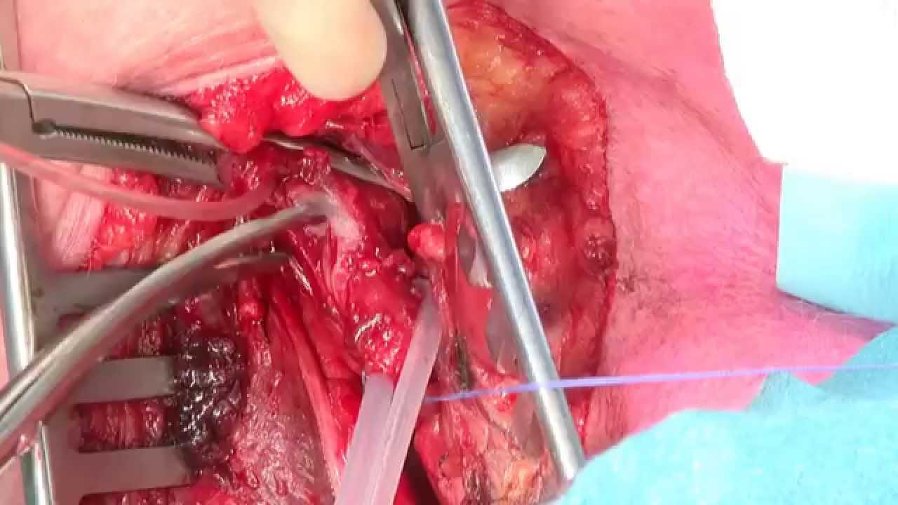 chimiothérapie mabthera medicament contre most cancers estomac
