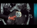 surgery