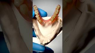 Fiberflex Partial For Lower Arch That My Lab Just Completed For Dr. Bernard Colonna In Illinois