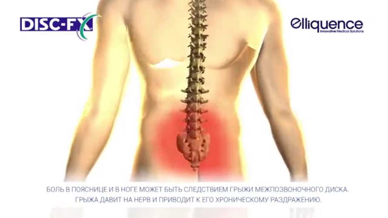 Стреляет в грудном отделе позвоночника Стреляет в грудном отделе позвоночника