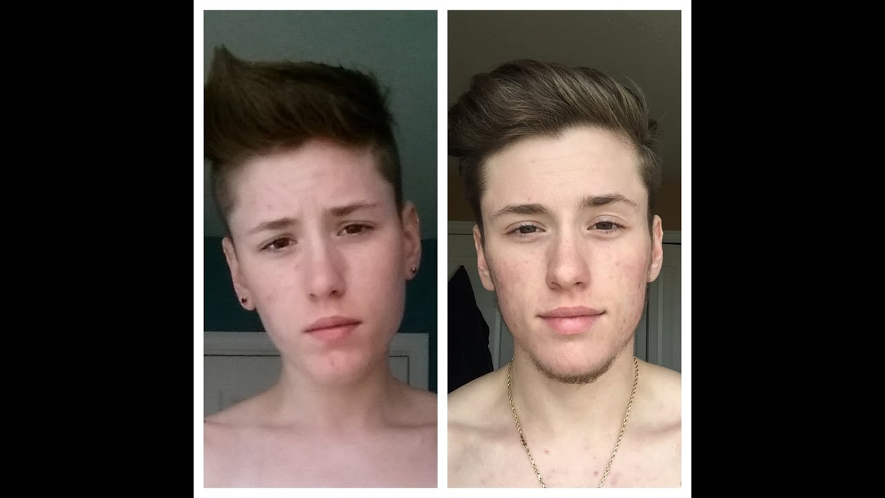 Ftm lesbian