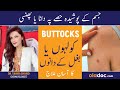 HOW TO REMOVE BUTTOCKS ACNE - Baghal Men Dana Nikalna - Hips/Underarm Pimple Treatment In Urdu/Hindi