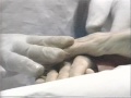 embalming