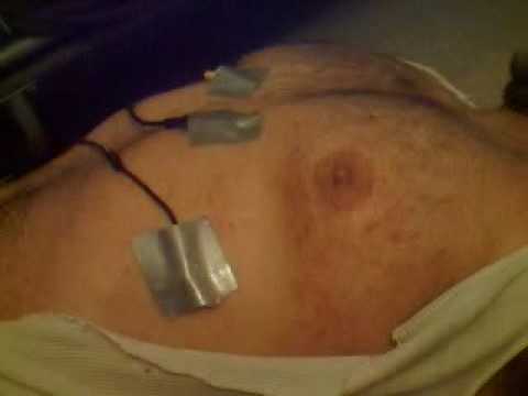 heart attack symptoms in men. heart attack symptoms in women. heart attack symptoms in men.
