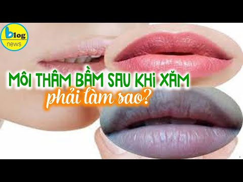 Môi bị thâm bầm sau khi phun xăm: Đừng hoảng loạn, hãy áp dụng cách xử lý này