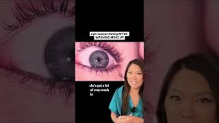 Eye Fishing