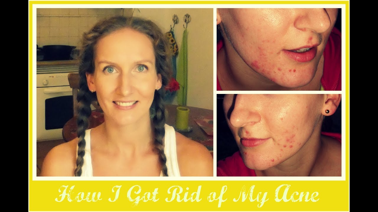 Ocm before and after pictures Ocm before and after pictures