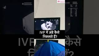 How Are Eggs Released In Ivf? Ovum Pickup Infertility Treatment Rashmi Agrawal