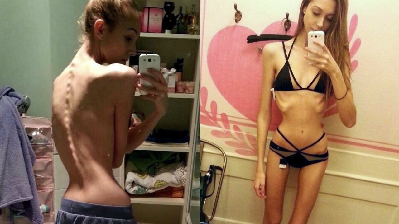 Anorexic inna fan image