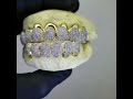 Clip Bustdown diamond prong set grillz done by aria & co jewelry