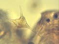 microscopic