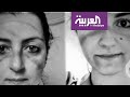 صور هزت مواقع التواصل لأطباء خارت قواهم في مع...