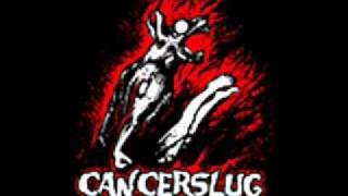 Watch Cancerslug Fuck You video