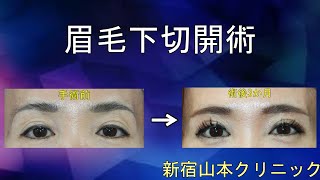 Private video