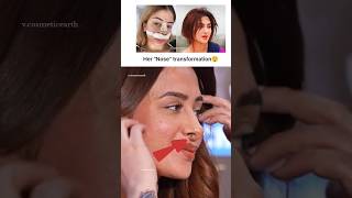 Mahira Sharma Nose Transformation