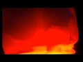 2 Hours Sleep Hypnosis for Depression Anxiety Self Confidence Emotional Healing