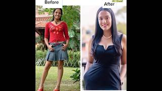 Nepali Actress Before And After..