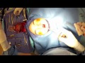 "Open" Rhinoplasty (Part 8) Dr. Naderi performs tip rhinoplasty sutures Washington DC & MD & VA