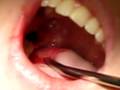 TOOTH!!