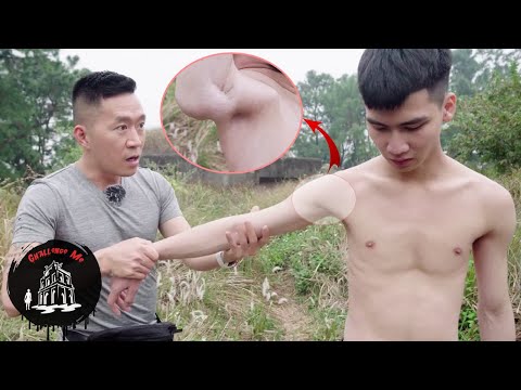 Dị Nhân Người Không Xương ở Sóc Sơn Hà Nội