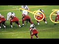 Viking's EJ Henderson Breaks Leg Full Video Slow Motion