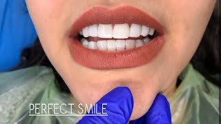 Perfect Smile Closeup Female Teeth