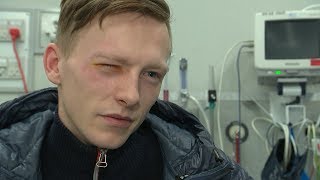 Flere Fyrværkeriskader Simon Havde Ikke Kerhedsbriller På - Dr Nyheder