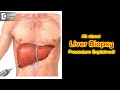 What is Liver Biopsy & Why is it done? Procedure | Diagnose Fast! -Dr. Ravindra BS | Doctors' Circle