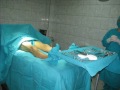 safenectomia