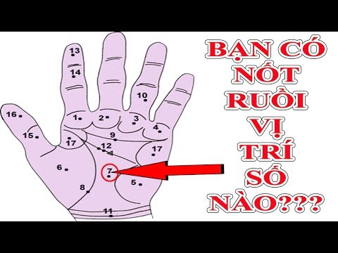 Xem "Vị Trí Nốt Ruồi Lòng Bàn Tay" Nói Gì Về Tương Lai SƯỚNG KHỔ Của Bạn Kết Quả thật Bất Ngờ