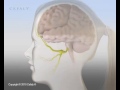 Cefaly Anti-Migraine/Headache Device Animation