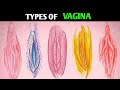 Types Of Vagina | Shapes and Size | Most Attractive Type