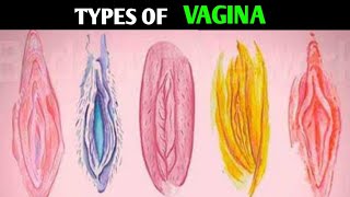 Types Of Vagina | Shapes and Size | Most Attractive Type