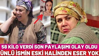 Oyuncu Yeşim Ceren Bozoğlunun Son Hali Şaşkınlık Yarattı