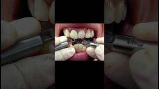 Asmr Dentist Tooth Work