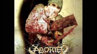 Watch Aborted Medical Deviance video