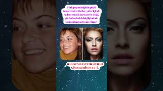 Hadisenim Estetiksiz Hali.