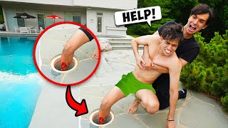I Almost Lost My FOOT!