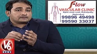 Varicose Veins Problem | Symptoms & Treatment | Dr. Abhilash | Good Health | V6 News