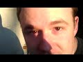 Droid Razr Unboxing Bad Screen