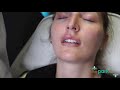 Introducing the Restylane Kysse Filler - The Park Clinic